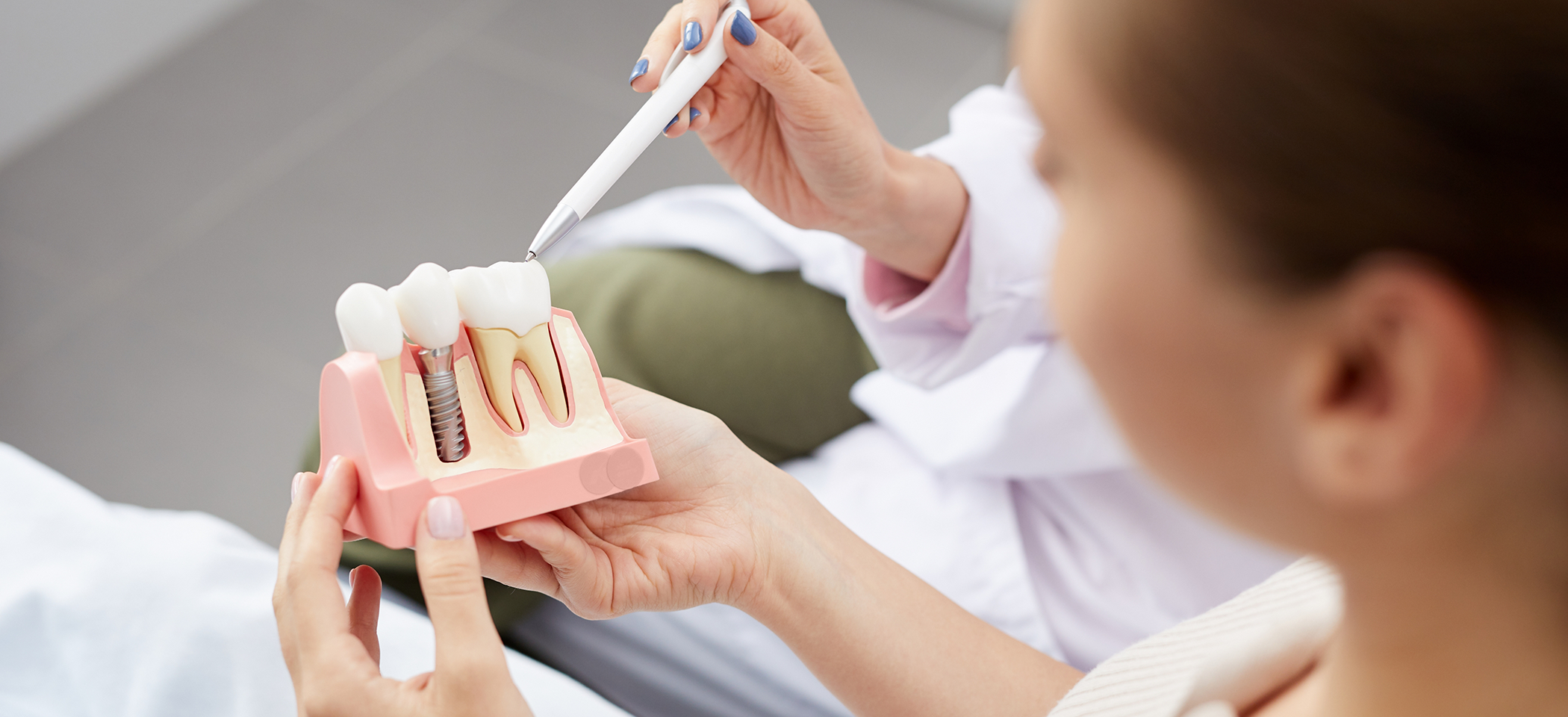 Dentist showing a patient a model of a dental implant in Cleburne