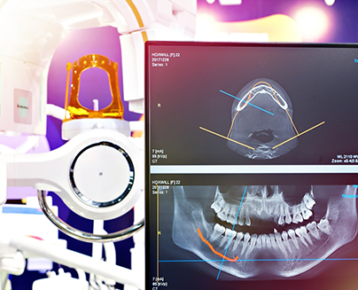 Computer screen showing digital x rays and models of a patients jaws and teeth