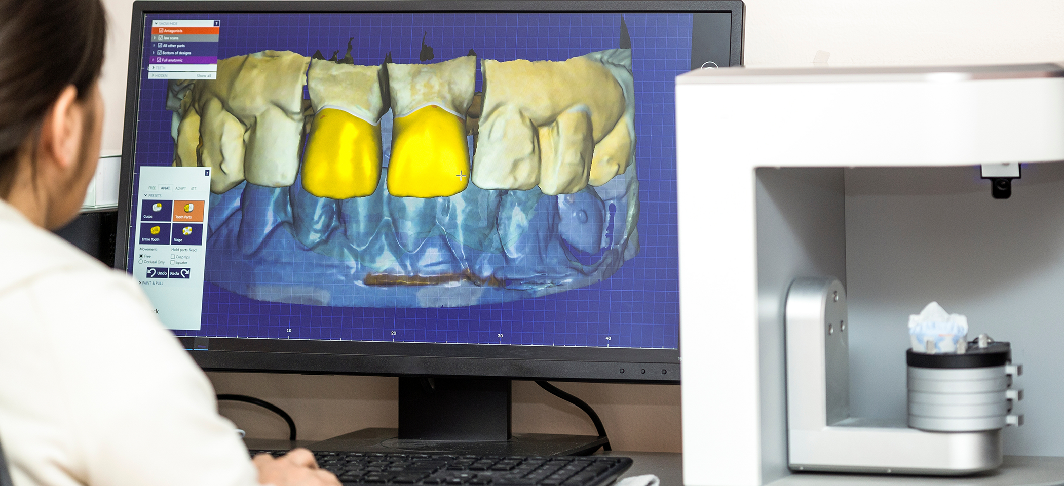 Dentist looking at digital scans of a patients teeth on a computer