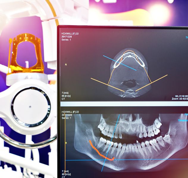 Screen showing digital x rays and scans of a patients mouth and jaws